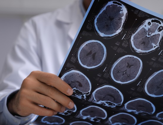 Doctor holding brain scans